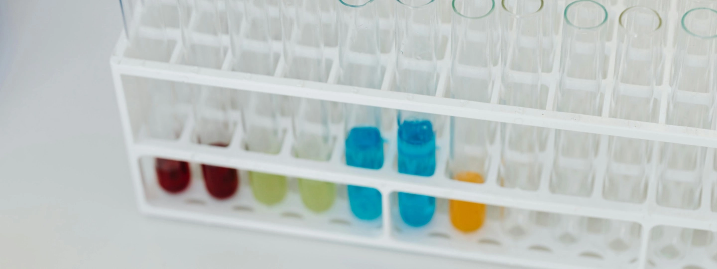 Foto von Photo By: Kaboompics.com: https://www.pexels.com/de-de/foto/labor-chemie-reagenzglaser-nahansicht-8540029/
